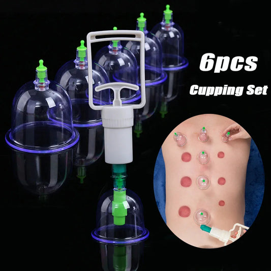 Vacuum Cupping Set - Chinese Medicine Therapy Suction Cups for Massage and Slimming